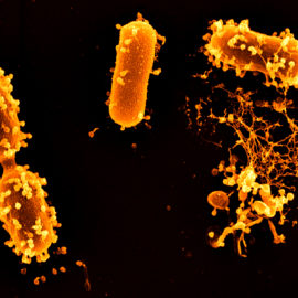 Bakterienfresser – Viren bekämpfen Infektionen